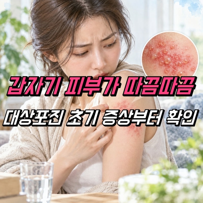 대상포진 증상 전염성 감염 주의