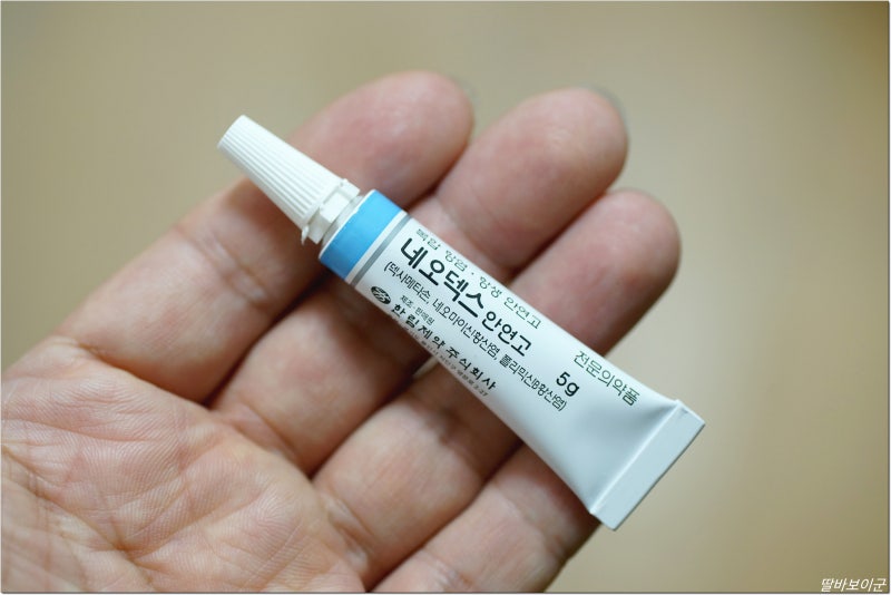 눈 다래끼 초기 증상! 치료 3일 후 네오덱스 안연고 사용해 보니