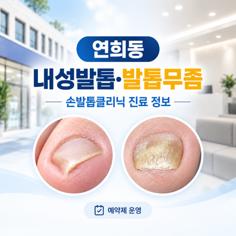 홍제내성발톱 치료병원을 찾는다면? | 내성발톱·발톱무좀 진료 과정과 예약 정보