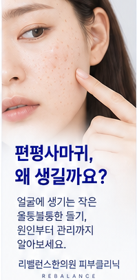 편평사마귀는 왜 생길까요? 얼굴 오돌토돌 원인부터 쥐젖·비립종 구별까지