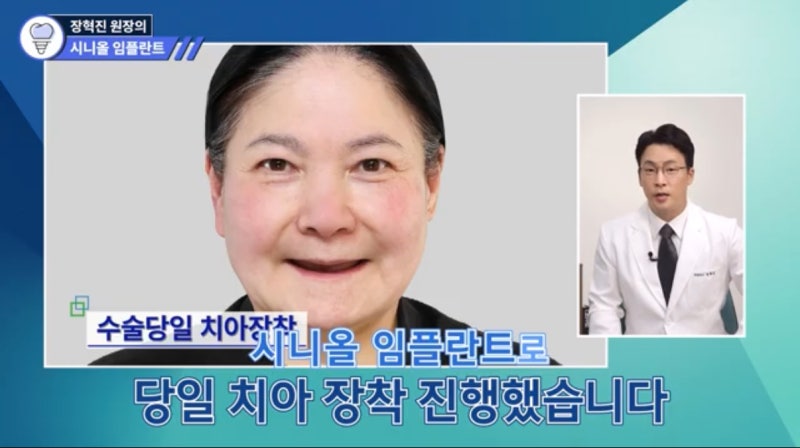65세 임플란트 무료? 건강보험 적용 기준과 비용 알아보기