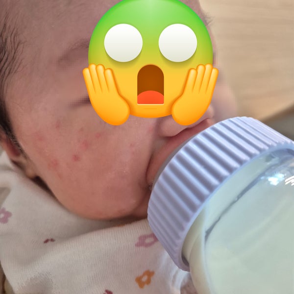 [위도어 가습기] 후기, 아기 태열과 침독 차이, 신생아 태열 관리에 가습기가 필요한 이유