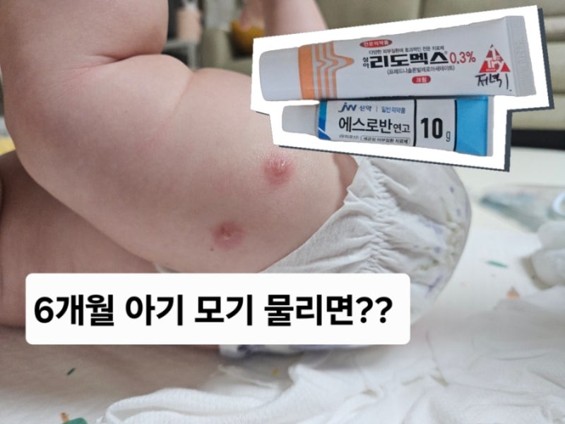 6개월 아기 모기 물릴때 비판텐? 모기물린 자국, 에스로반, 리도맥스, 가을모기