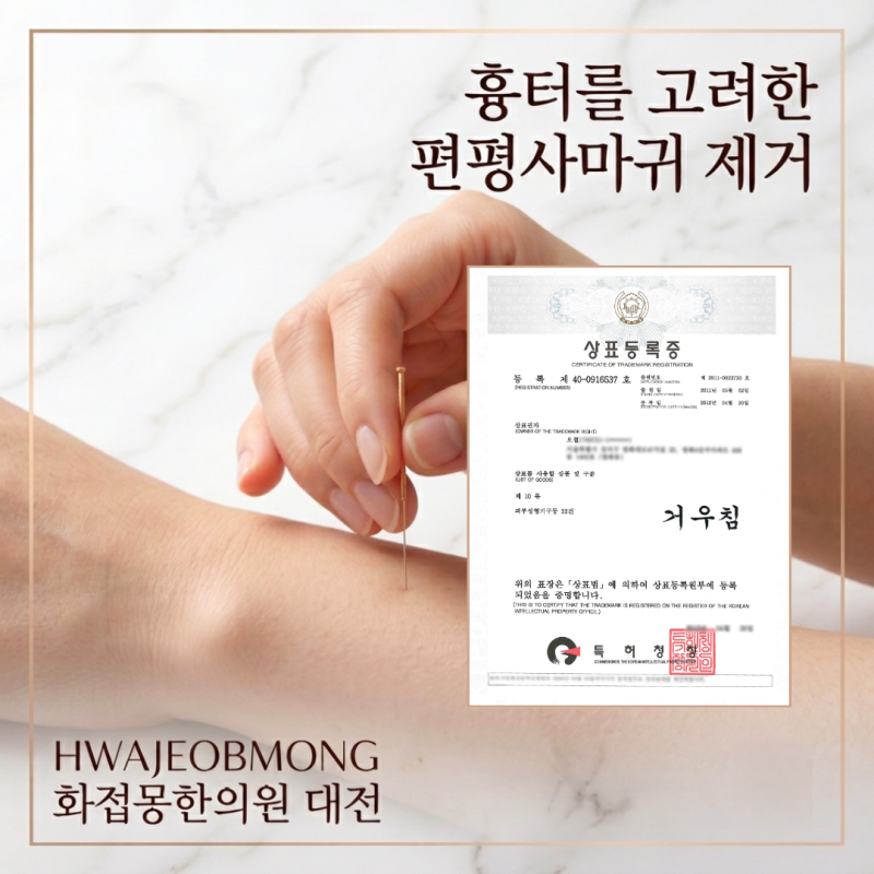 대전편평사마귀) 거우침으로 편평사마귀 제거 후 관리 방법