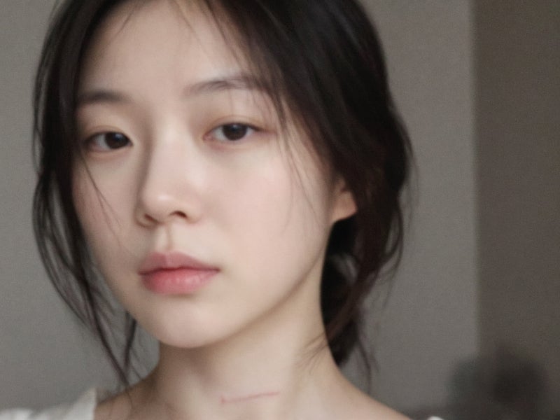 켈로이드흉터없애는법 비수술적 복합 치료 방식