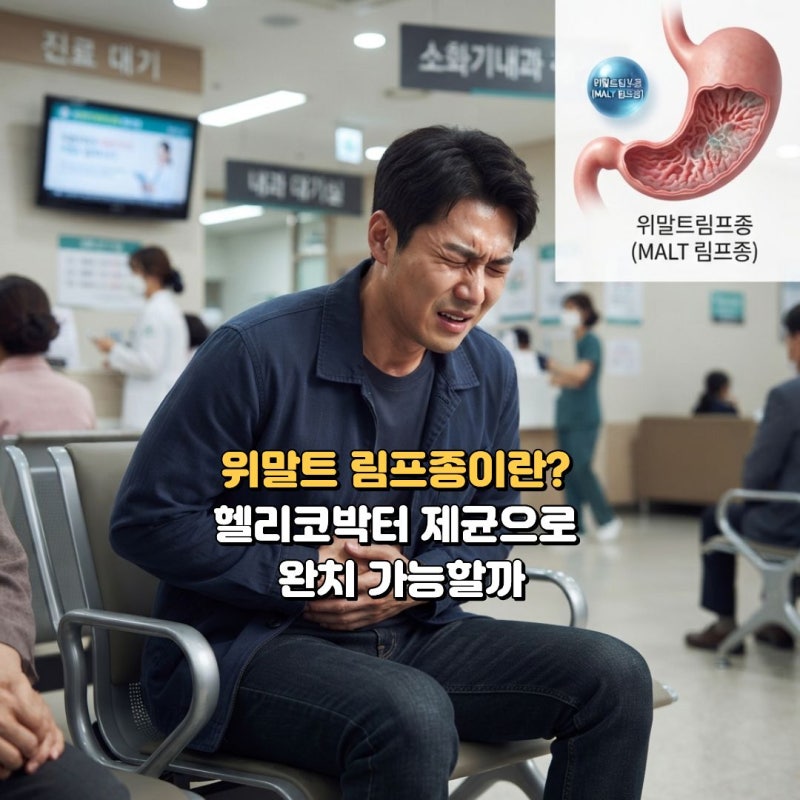 위말트림프종 초기증상 및 원인, 헬리코박터 제균 치료 완치율과 생존율