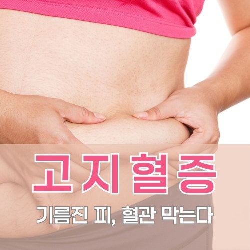 고지혈증 증상이 없다고 안심? 원인·수치·나쁜음식까지 총정리! 이상지질혈증과 뭐가 다를....