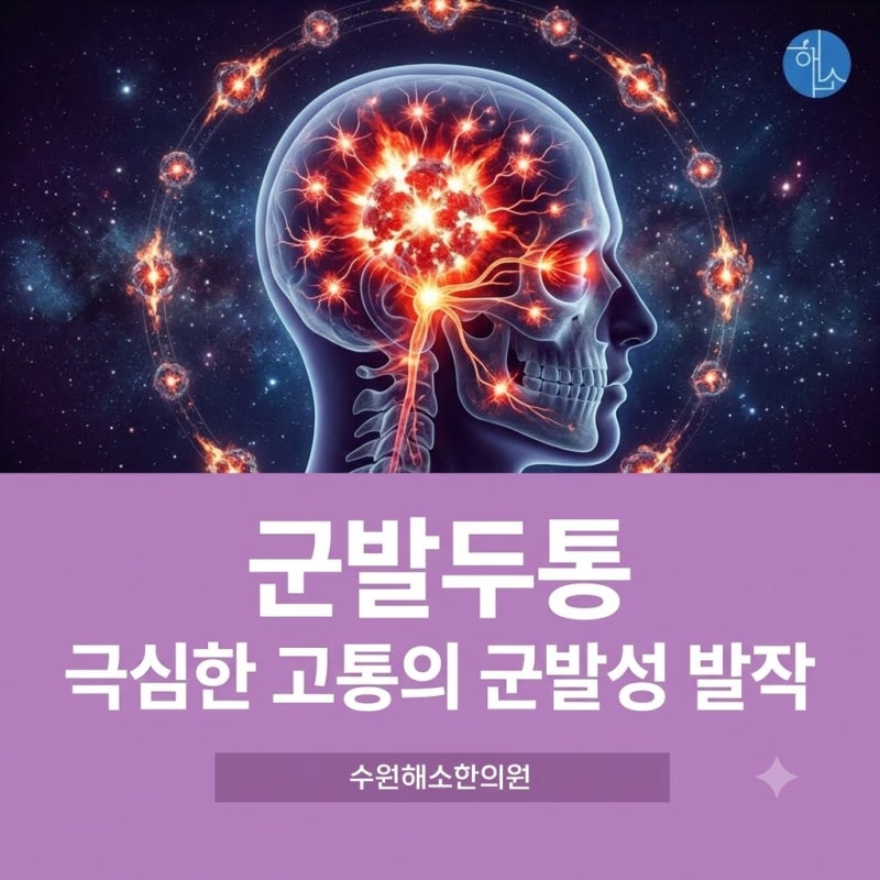 [ 망포 두통한의원] 출산보다 고통스럽다는 군발두통, 발작처럼 찾아오는 이유