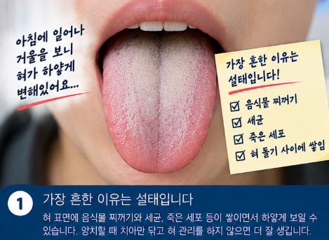 혀가 하얗게 되는 이유, 양치했는데도 하얀 설태가 생긴다면?