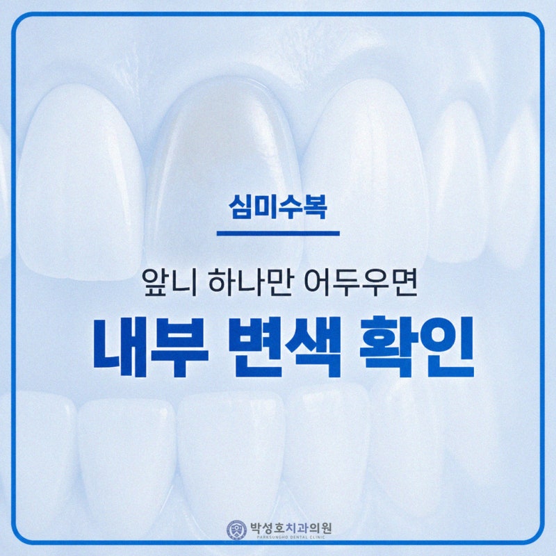 심미수복, 변색되거나 색이 다른 앞니를 개선하는 방법은?