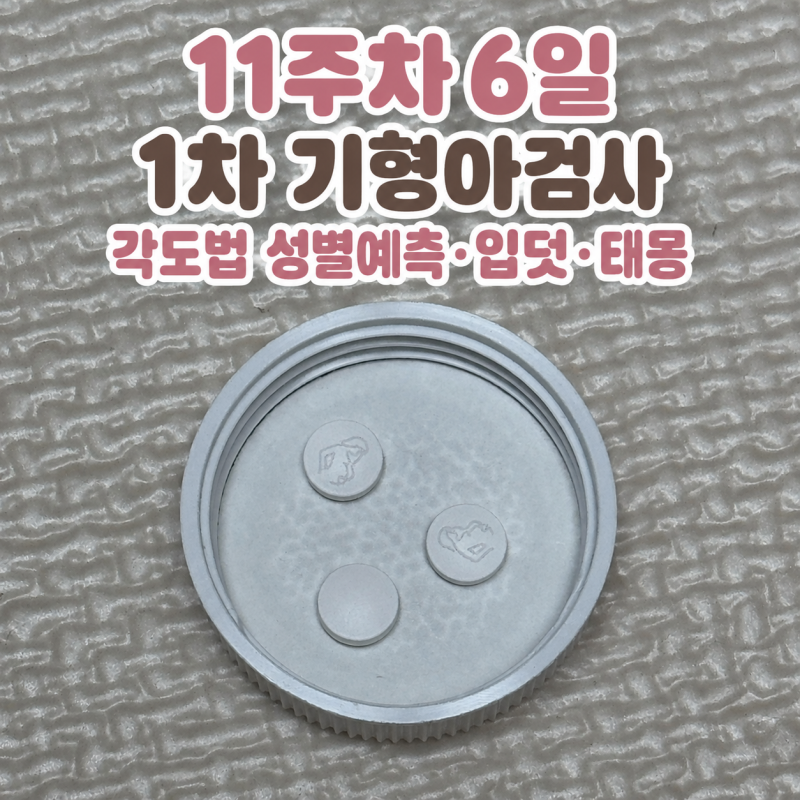 11주 6일차 1차 기형아검사(각도법으로 성별 예측 및 입덧, 태몽)