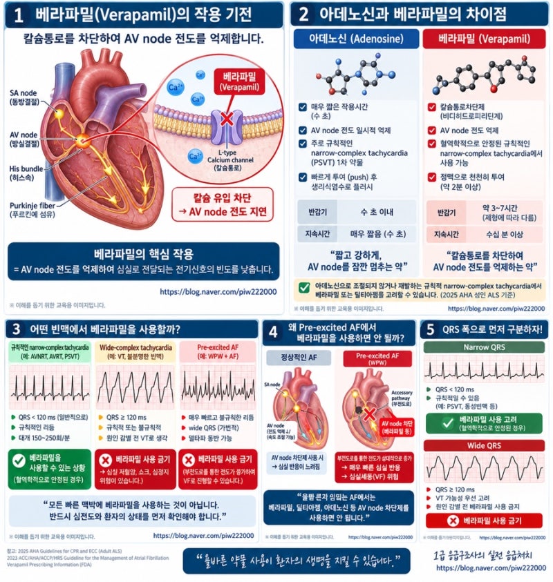 [응급약물 공부노트]⑧ 베라파밀(Verapamil)｜빠른 심박수를 어떻게 낮출까?