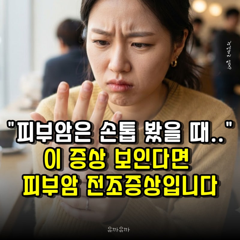 "손톱 봤을 때" 이 증상 보인다면 피부암 전조증상입니다, 꼭 기억하세요