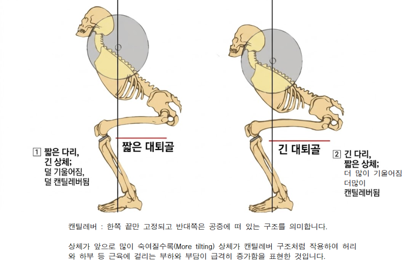 스쿼트할 때 고관절 앞쪽이 찝히는 이유 깊이·골반 모양·다리 길이의 영향