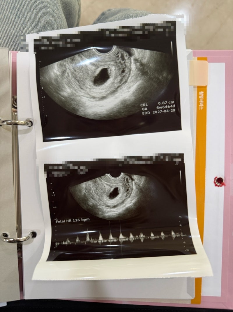 부천 서울여성병원 임신확인부터 보건소 임산부 등록, 공영주차장 할인까지