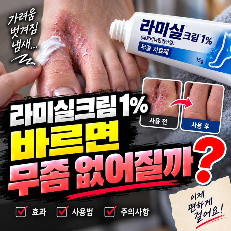 라미실크림 1% 바르면 무좀 없어질까? 효과·사용법 제대로 알아보기