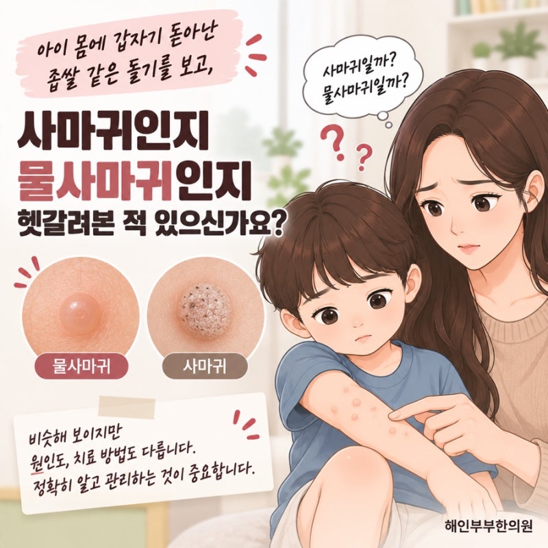 수원 물사마귀 vs 사마귀, 헷갈리는 차이점 총정리