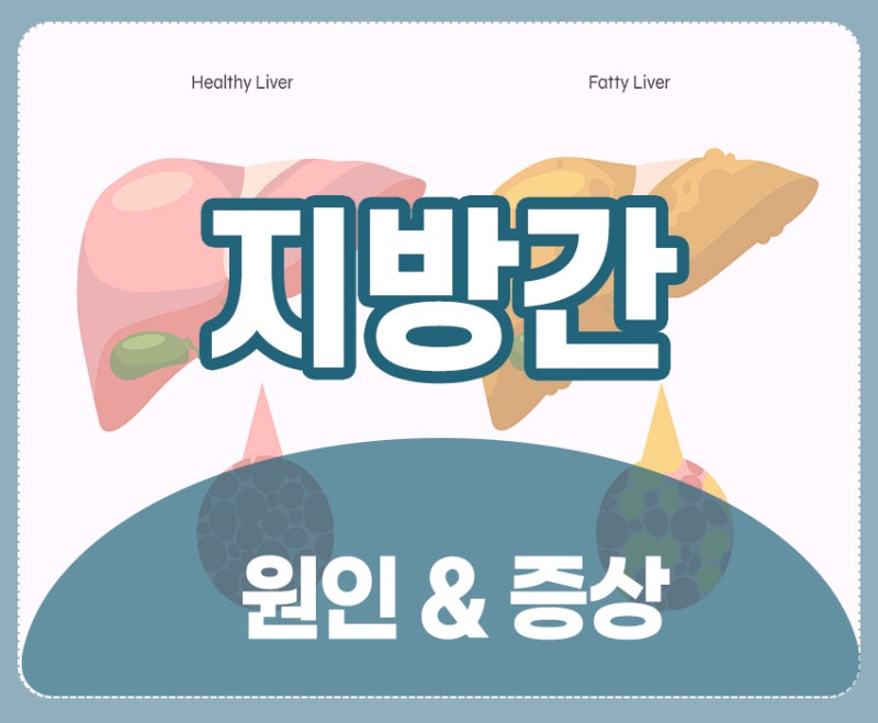지방간증상, 지방간원인 , 치료 , 비알콜성지방간및 지방간에좋은음식 핵심 케어