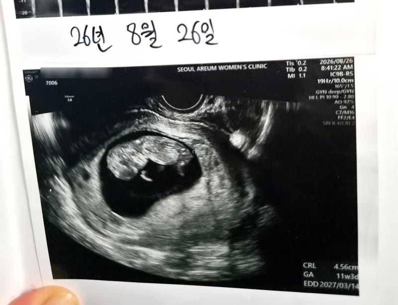 출산 2년 만에 둘째 임신ㅋㅋ 안양 산후조리원 가격 비교 + 안양종로약국 임산부 영양제 가격