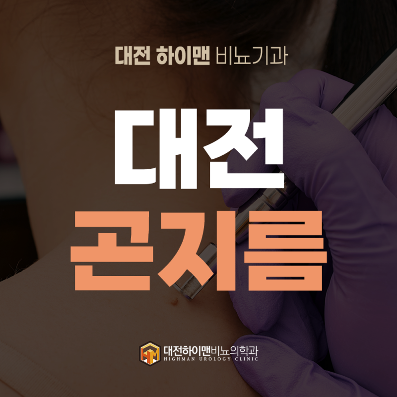 [대전] 곤지름 걸렸을 때 가다실 9가 맞으면 치료 효과가 있을까?