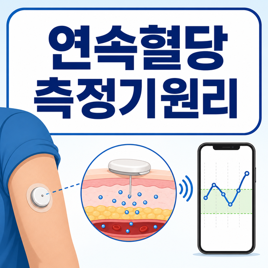 연속 혈당 측정기 원리, 혈액 대신 조직액을 보는 이유