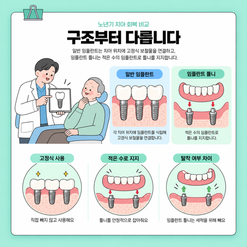 노인 임플란트와 임플란트 틀니 어떤게 적합할까? 가격이나 실제 일상생활 속에서의 차이 비....