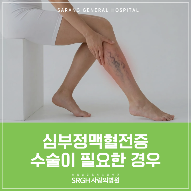 안산 심부정맥혈전증, 한쪽 다리가 붓고 아프다면?