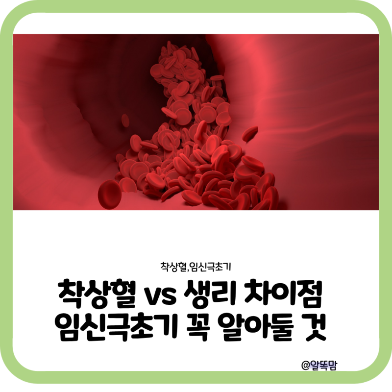착상혈 vs 생리 차이점｜임신극초기 꼭 알아둘 것