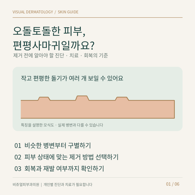 편평사마귀 제거, 얼굴의 오돌토돌한 돌기가 신경 쓰인다면
