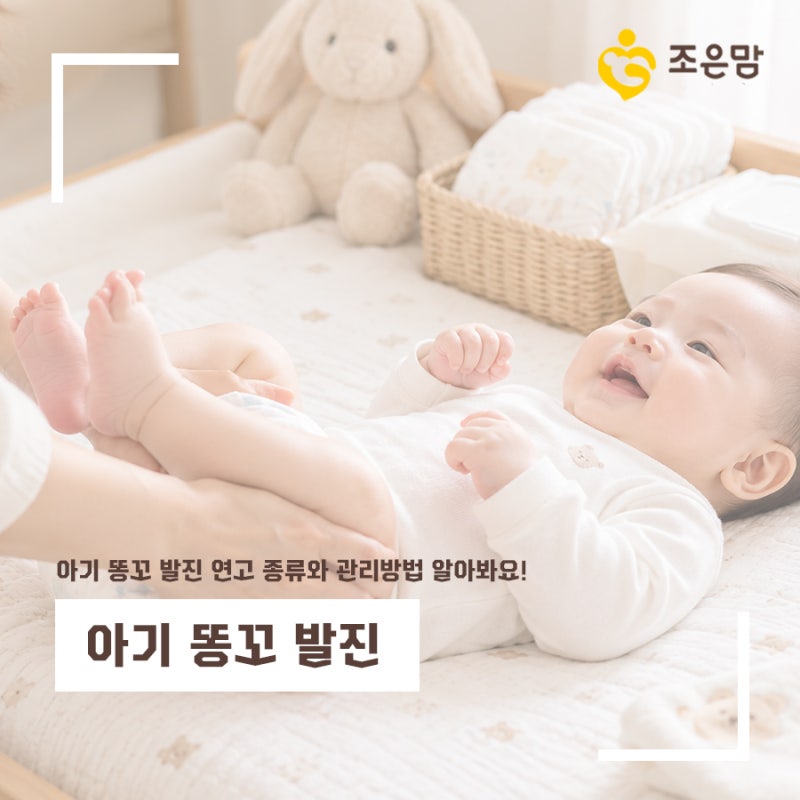아기 똥꼬 발진 원인은? 아기 똥꼬 발진 연고 종류와 관리방법 알아봐요