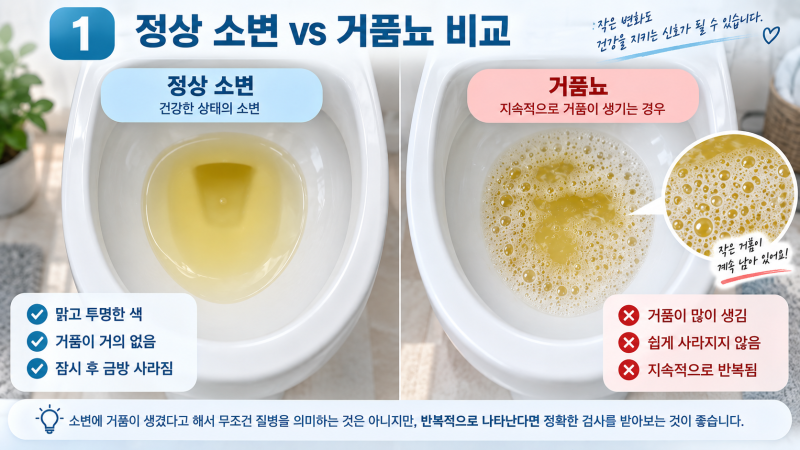 소변에 거품 많이 나면 무조건 신장 문제일까? (반전 주의)