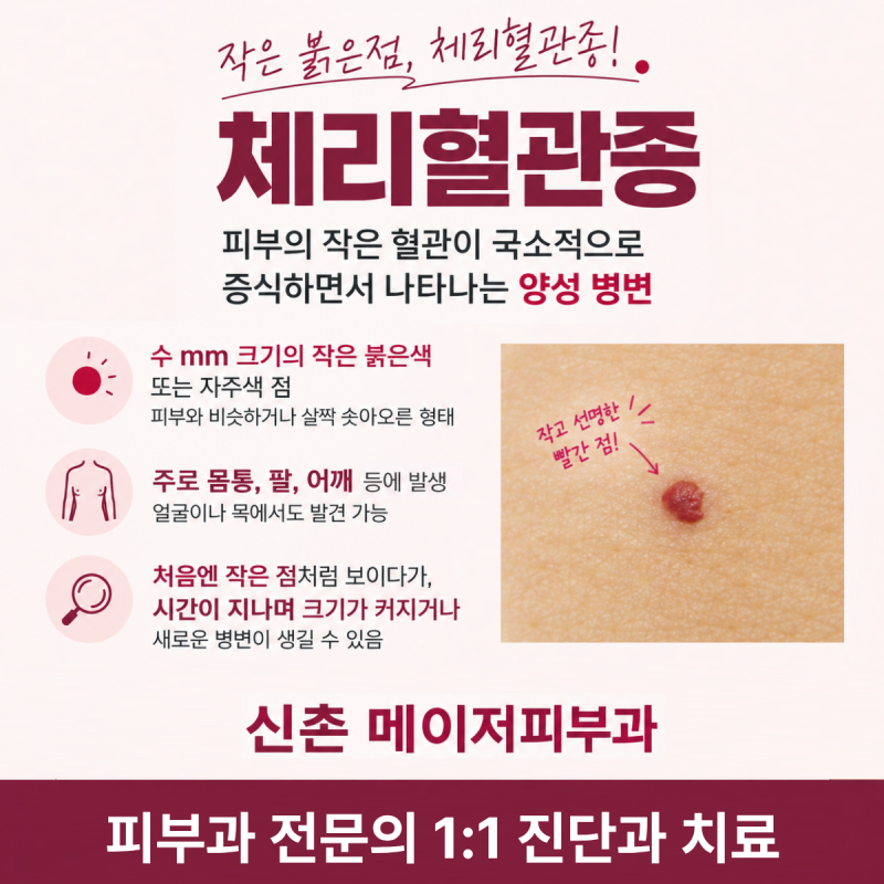 얼굴과 몸에 빨간 점이 생겼다면? 체리혈관종(체리점) 버찌혈관종 붉은점의 원인과 치료 제....