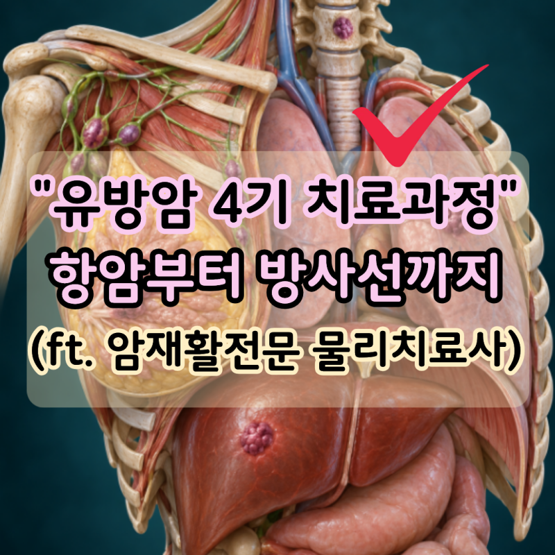"유방암 4기 진단" 항암은 얼마나 받을까? 수술과 방사선 치료까지 (ft. 암재활전문 물리치료....