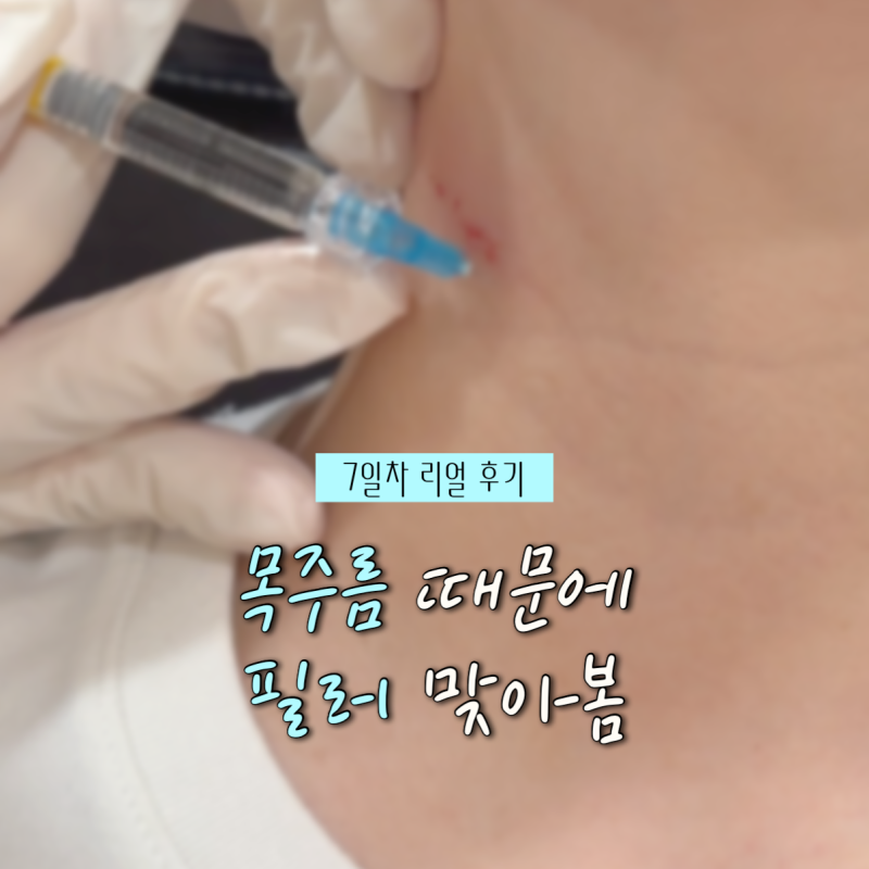 수원 망포 목주름 필러 1차 후기 | 1일차~7일차 변화 기록 (feat. 빨간 자국)