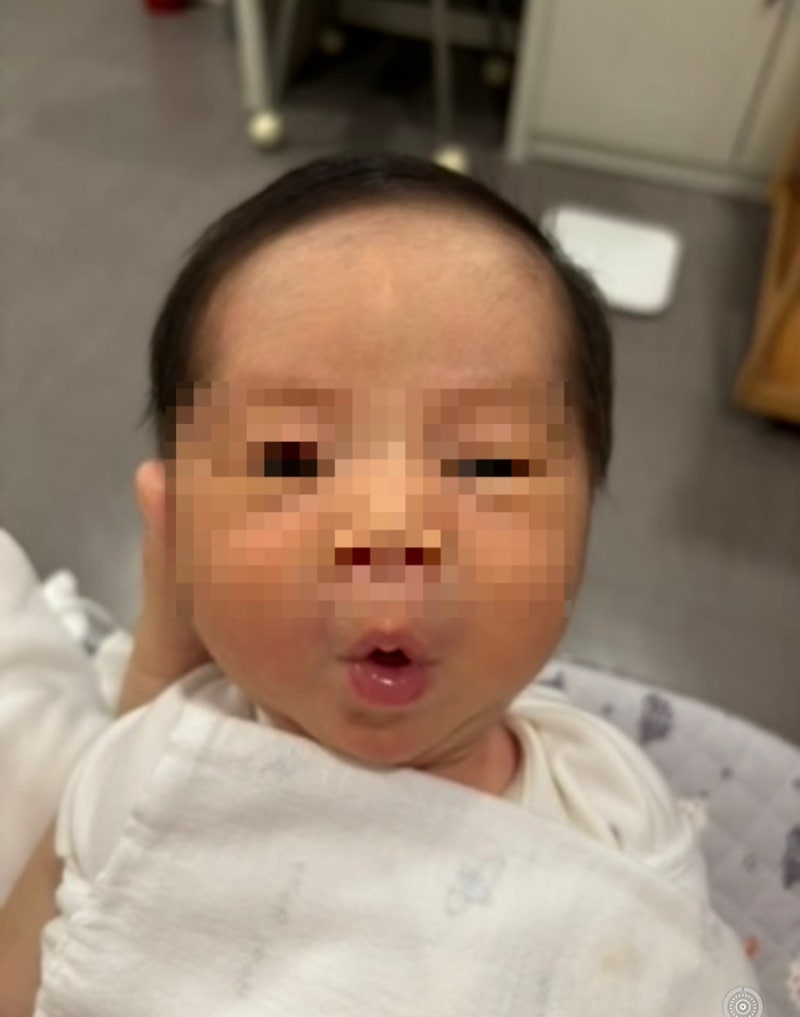 신생아 황달 원인•증상•대처방법