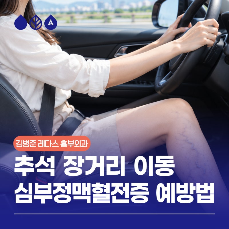 추석 장거리 이동 심부정맥혈전증 예방법은?