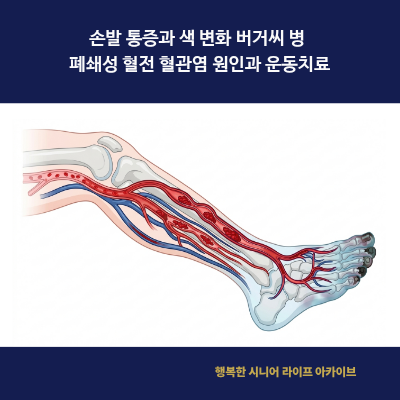 손발 통증과 색 변화 버거씨 병 폐쇄성 혈전 혈관염 원인과 운동치료