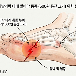 오래 서서 일하는 사람의 신발 찾기 | 주방 슬리퍼부터 르무통, 스케쳐스 고워크 솔직 후기