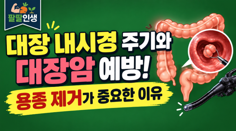 대장 내시경 주기와 대장암 예방! 용종 제거가 중요한 이유