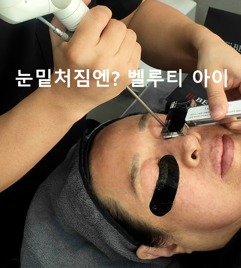 벨루티 아이, 효과와 유지기간까지 한 번에 정리 [분당눈밑꺼짐전문]