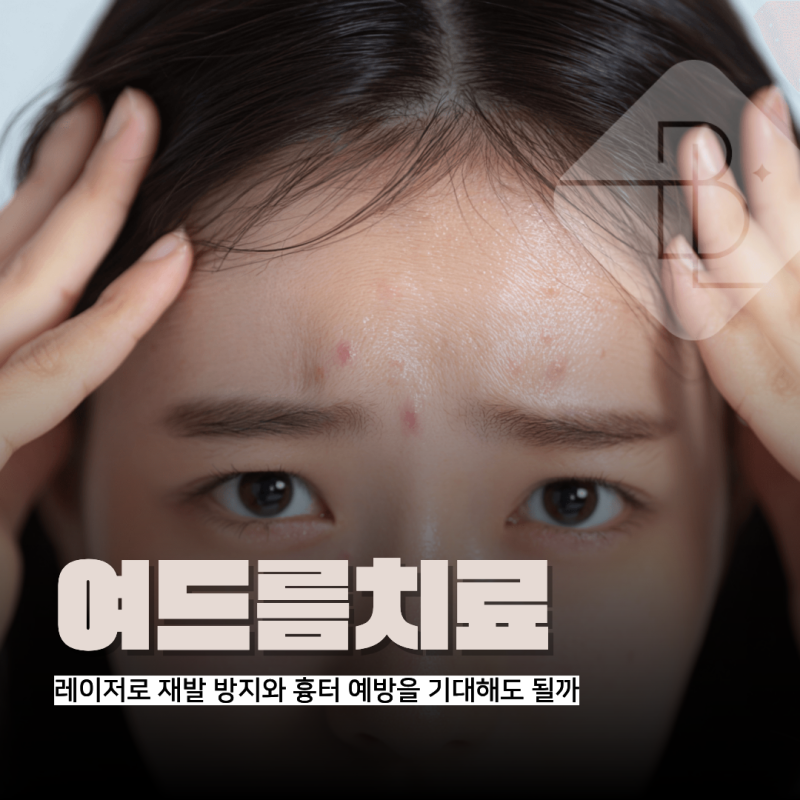 수완지구여드름 레이저로 재발 방지와 흉터 예방을 기대해도 될까