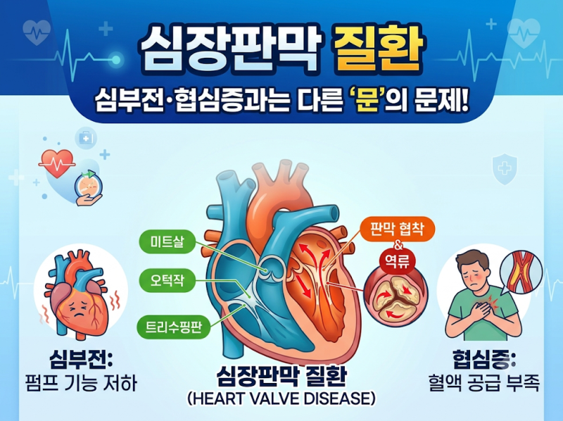 시니어건강 | 심장판막 질환,심부전·협심증과는 완전히 다릅니다