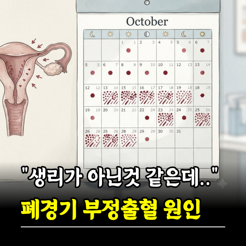 "생리가 아닌것 같은데.." 폐경기 부정출혈 원인 병원 가야 할 신호