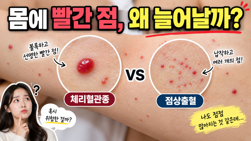 몸에 작은 빨간 점이 점점 많아지는 이유는? 체리혈관종·점상출혈 어떻게 구별할까?
