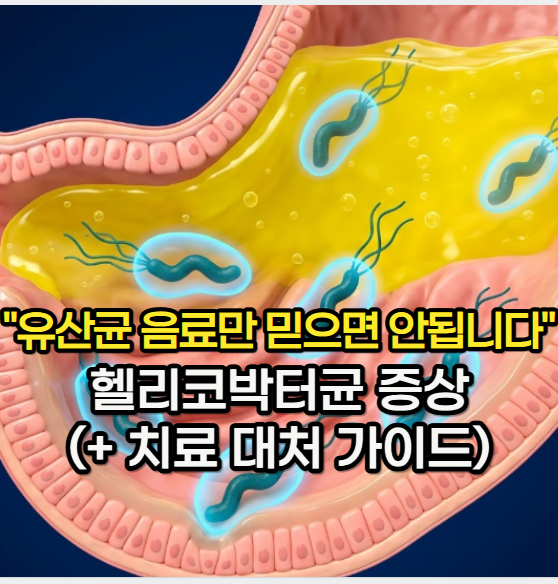 헬리코박터균, "유산균음료만 믿으면 안 되는" 헬리코박터균 증상 및 치료 대처 가이드
