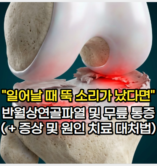 "앉았다 일어날 때 뚝 소리 났다면" 반월상연골파열 및 무릎 통증 증상 및 원인 ( + 치료 대처....