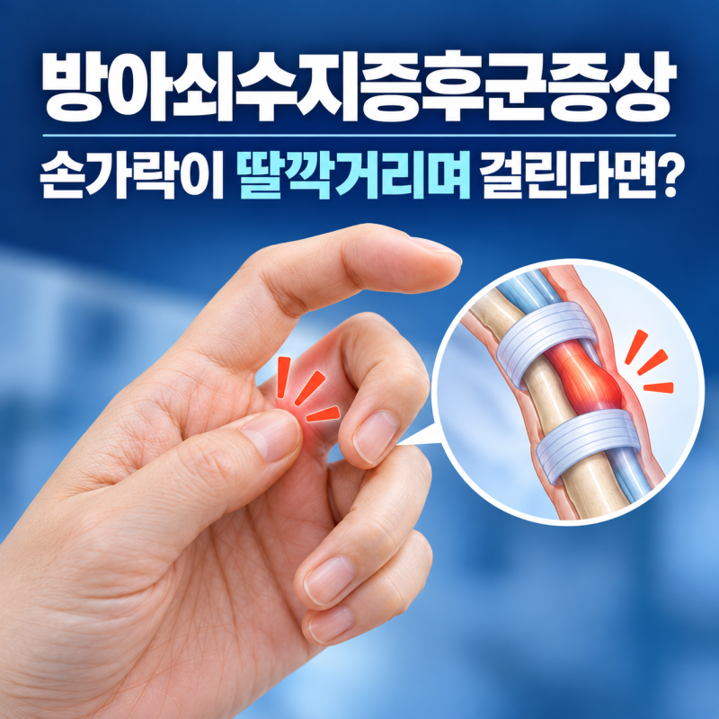 방아쇠수지증후군증상, 손가락이 딸깍거리며 걸린다면?