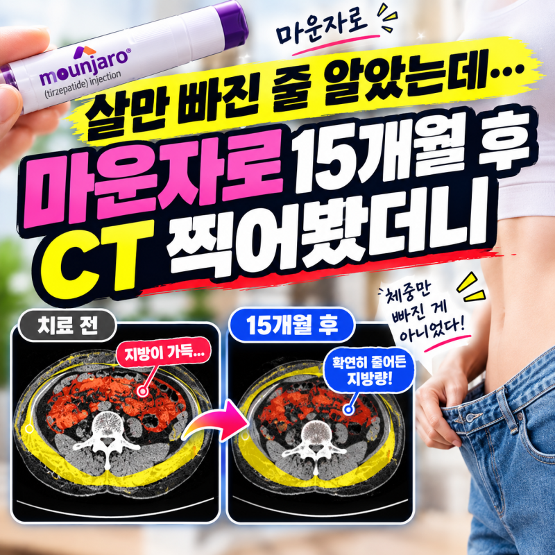 “살만 빠진 줄 알았는데…” 마운자로 15개월 후 CT 찍어봤더니