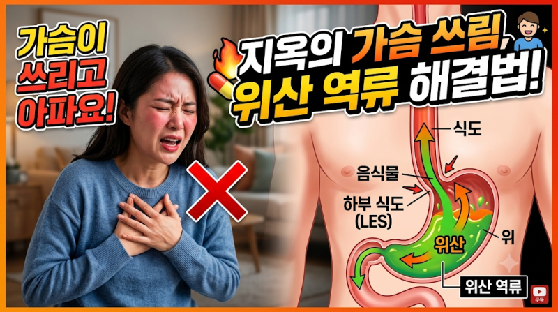 역류성 식도염 초기증상 명치 통증 위에 좋은 음식 정리 (+ 통증 완화 자세)