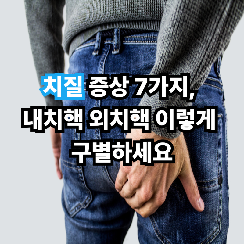 치질 증상 7가지, 내치핵 외치핵 이렇게 구별하세요